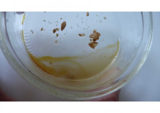 Jodprobe zeigt jodnormal, alles schick!